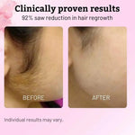 Hair Removal Care Serum Relieves Gentle Moisturizing Care Skin Smooth Nourishing Skin for After Hair Removal and Shaving BareGlow