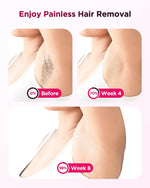 990000 Flash Laser Epilator IPL Hair Removal For Men and Women Body Bikini Facial  Permanant Painless IPL Hair Remover Machine BareGlow