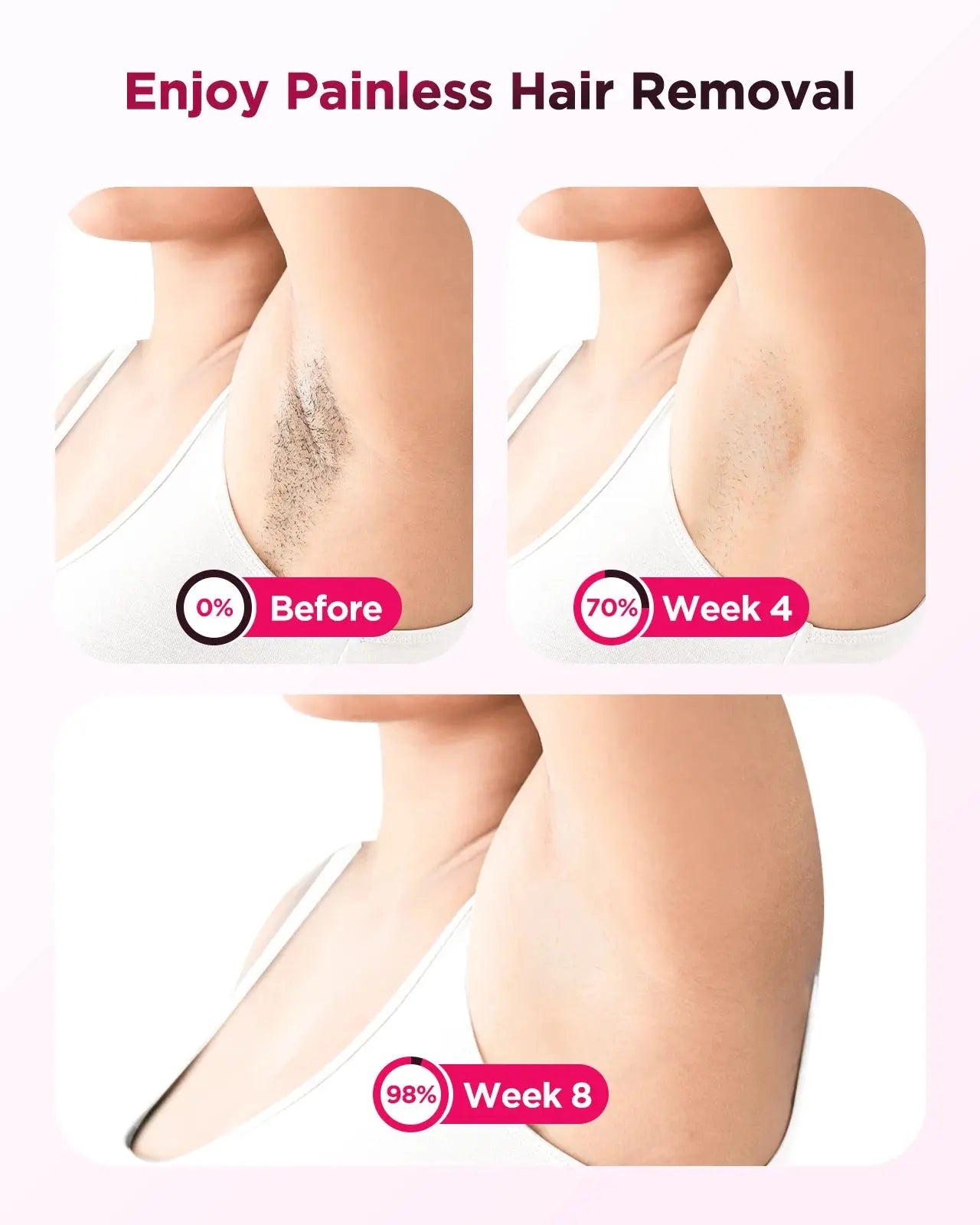 990000 Flash Laser Epilator IPL Hair Removal For Men and Women Body Bikini Facial  Permanant Painless IPL Hair Remover Machine BareGlow